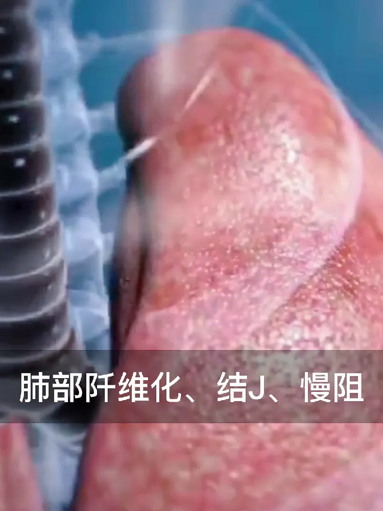 一吃一个不咳嗽！肺部状态回春啦！