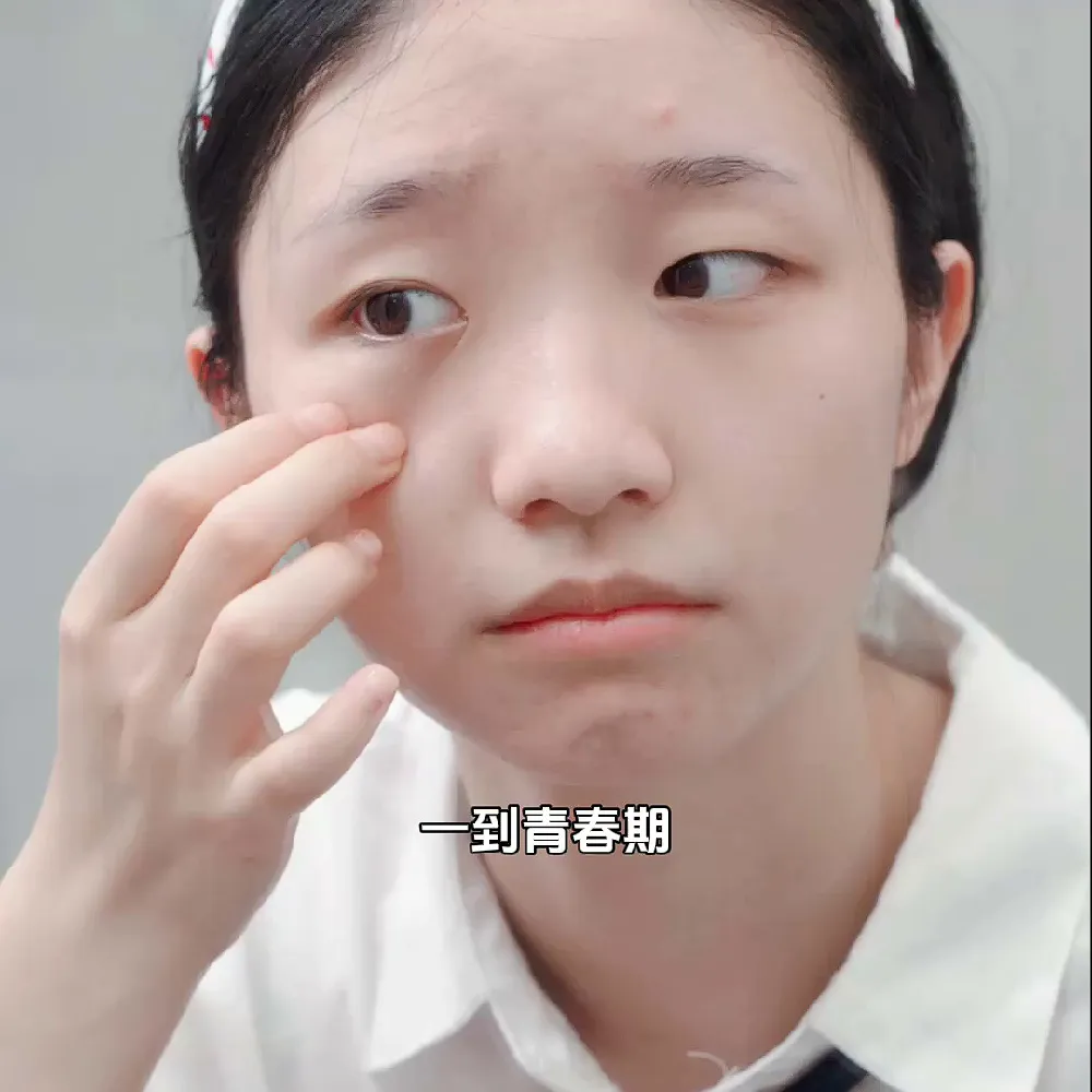 不懂原理但真的控油祛痘超绝！