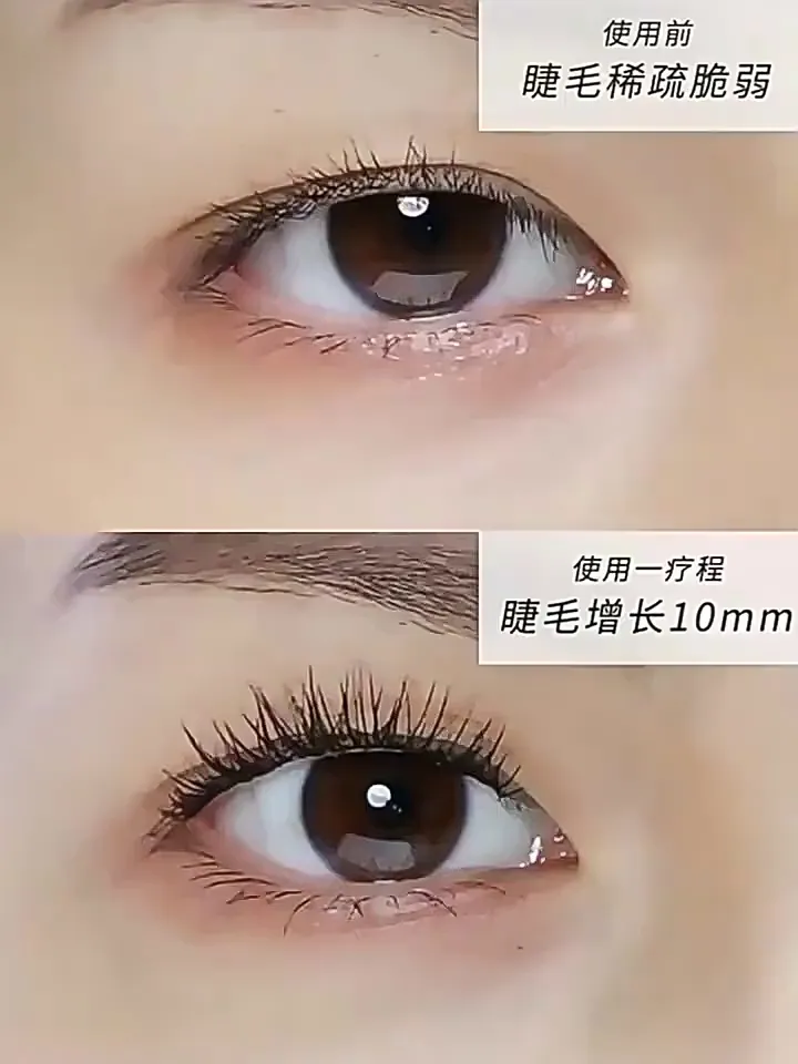 睫毛星人看过来!终于找到本命睫毛增长液了✌️