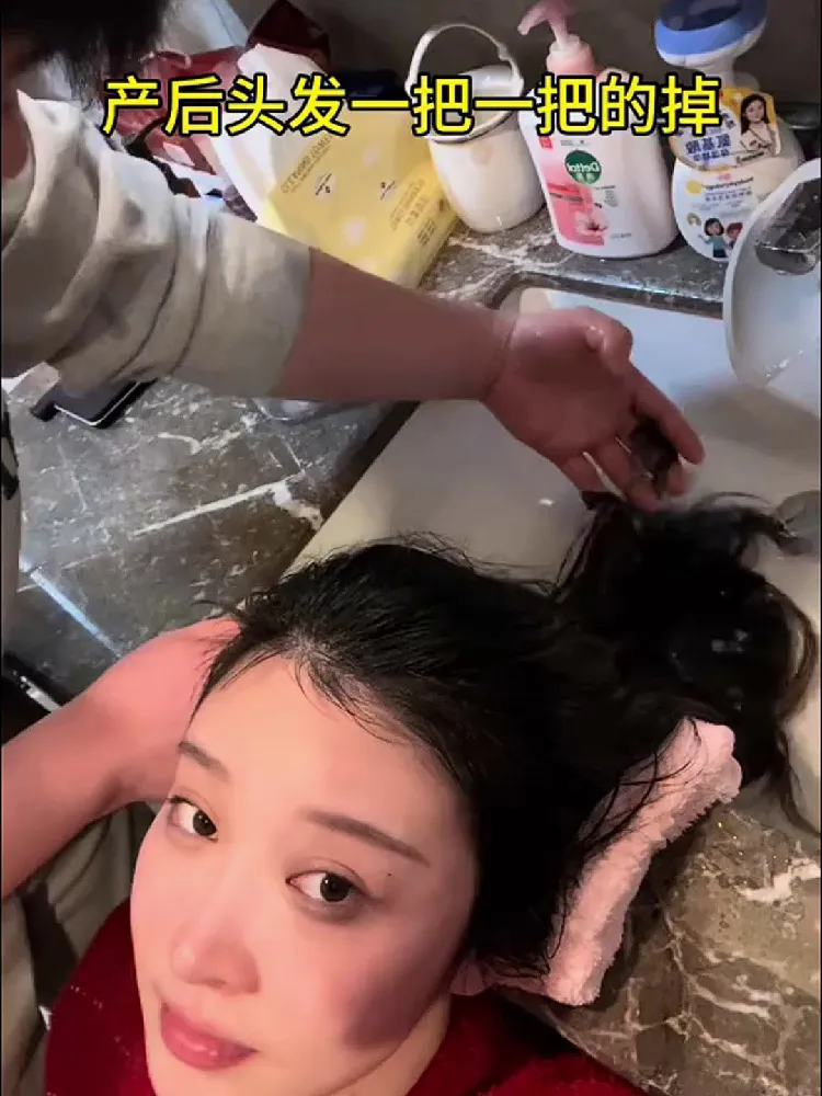 不止止脱!!发缝越用越窄💡