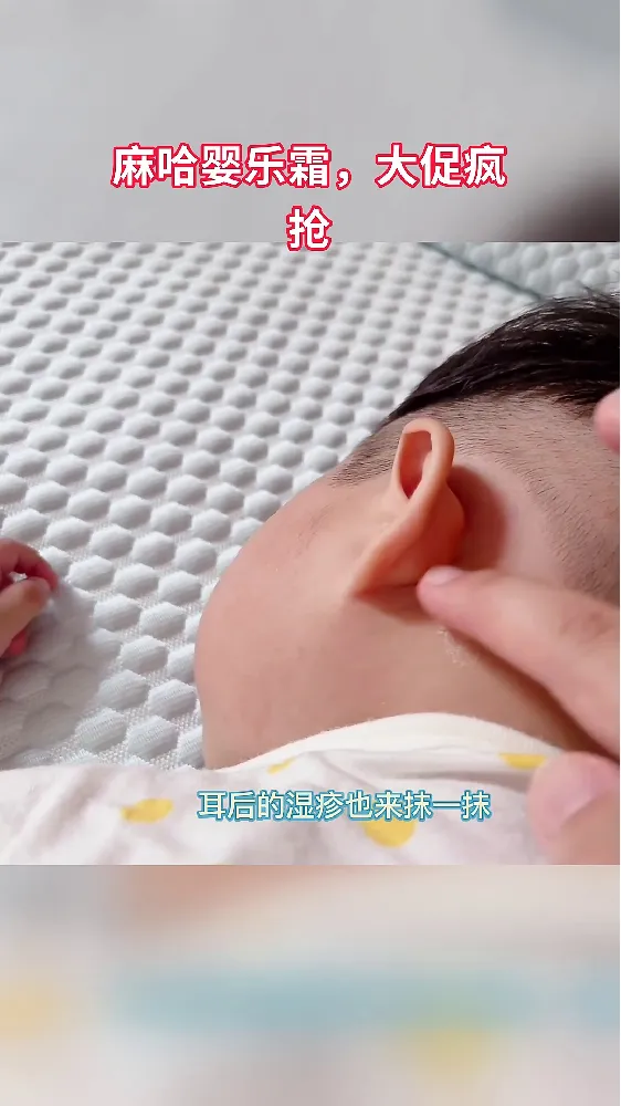 宝宝肌肤救星!红屁屁、湿痒、痱子全搞定!